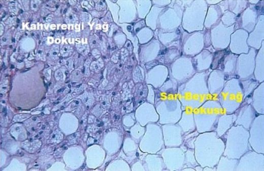 Adipoz Dokunun Kütlesi